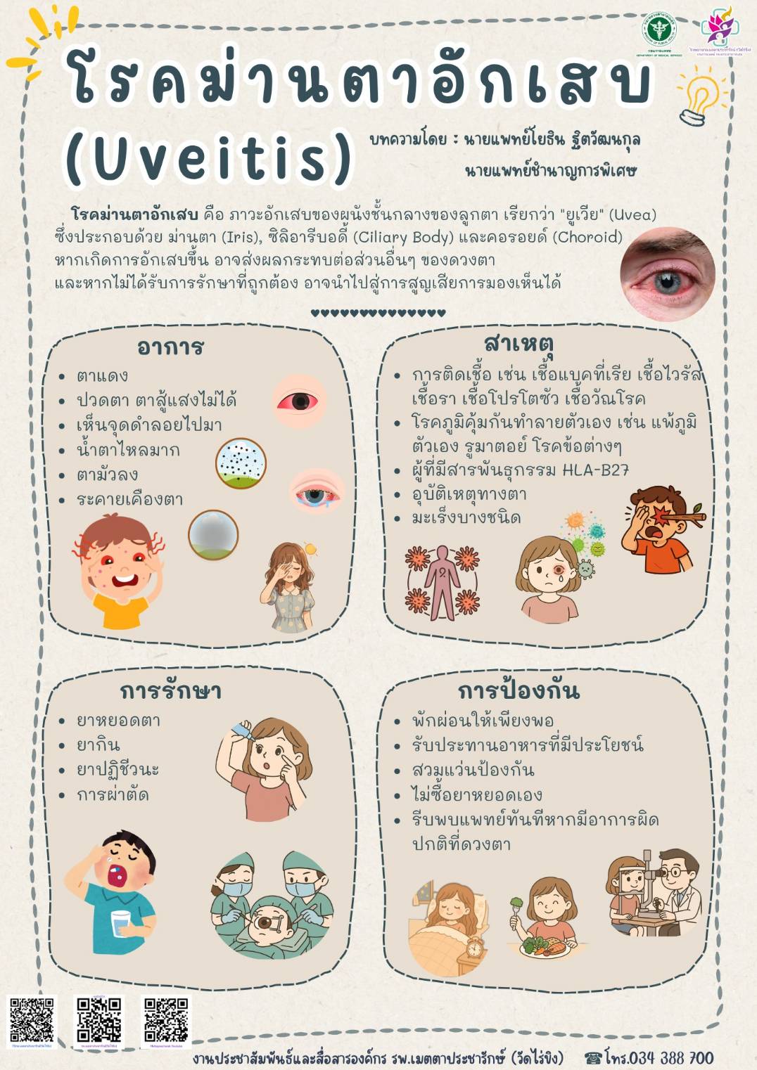 ภาวะม่านตาอักเสบ ส่อสัญญาณของปัญหาสุขภาพที่ไม่ควรมองข้าม